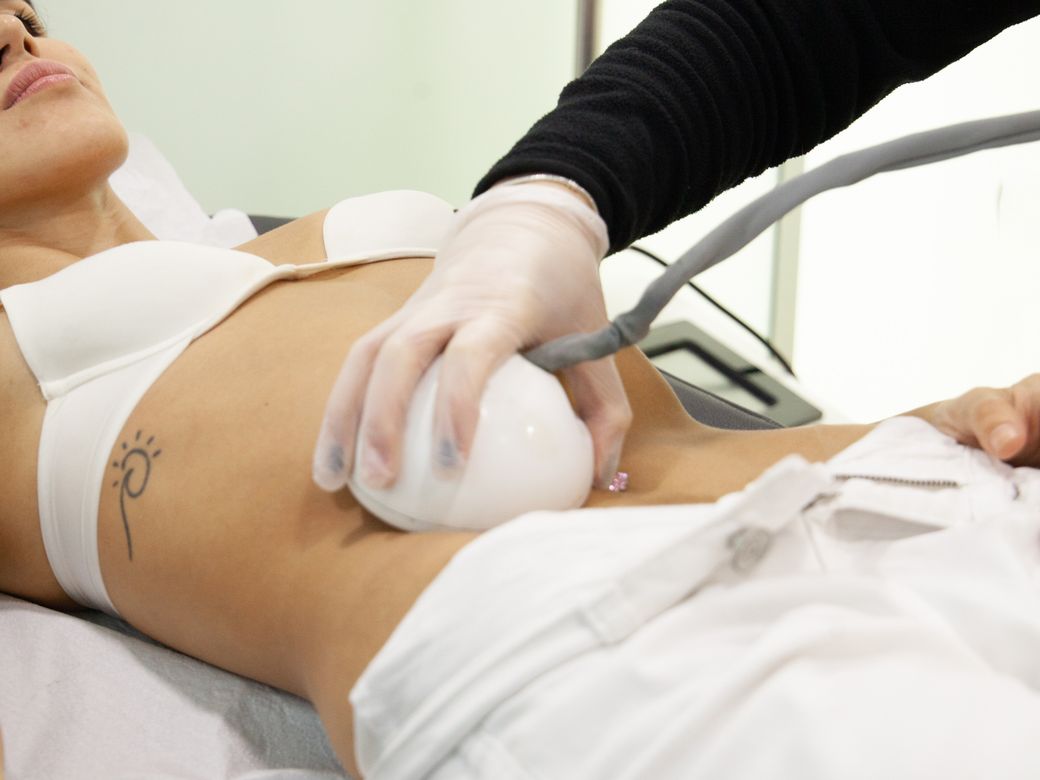 Aplicador del Venus Freeze sobre el abdomen durante una sesión en la clínica
